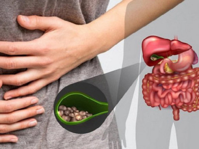 Vì sao người bị bệnh sỏi mật không nên ăn thực phẩm nhiều dầu mỡ?